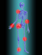 Polypathologie