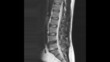 MRI Scan 20 seconds MRI Scan 20 seconds