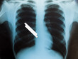 Photo: Smoking kills,concept Smoking kills,concept