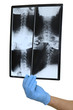 Doctor with x-ray