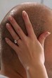 Hand aufs Kopf