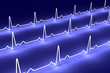EKG Puls