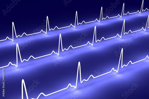 Illustration: EKG Puls EKG Puls