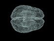 x-ray brain