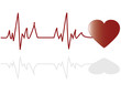 Illustration of an electrocardiogram (ECG)