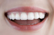 perfect smile