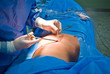 Operation