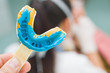 Dental imprint