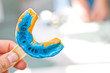 Dental imprint
