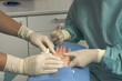 Operation