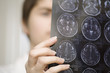 Female doctor holding CAT scan