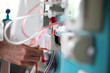 krankenhaus dialyse krankenhaus dialyse