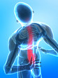 Pain in bottom side of spine