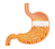 stomach 2