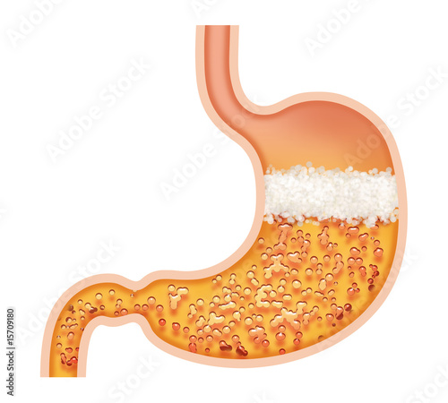 Illustration: stomach 2 stomach 2