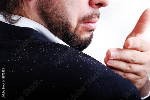 Photo: Dandruff issue on man's sholder Dandruff issue on man's sholder