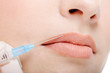 Cosmetic injection in the female lips