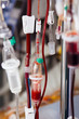 blood transfusion in hospital