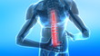 Video: Spread pain in human spine Spread pain in human spine