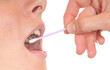 DNA-Analyse