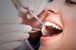Photo: dental checkup dental checkup