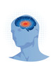 Anatomie du cerveau