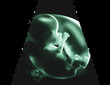 ultrasound2