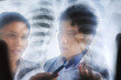 Asian doctors having discussion over xray print