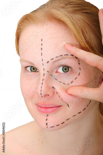 Photo: woman´s face before plastic surgery, face lift woman´s face before plastic surgery, face lift