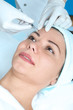 Foto: woman receiving a botox injection woman receiving a botox injection
