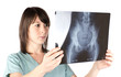 médecin qui observe une radio du bassin