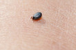 Gemeiner Holzbock - Zecke (Ixodes ricinus)