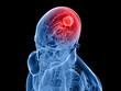 transparenter Schädel mit Hirntumor