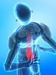 Pain in spine concept - rear x-ray view Pain in spine concept - rear x-ray view