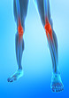 X-ray view of human knee X-ray view of human knee