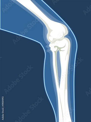 Illustration: Illustration of human leg bones Illustration of human leg bones