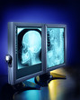 Illustration: Large X-rays viewed on hospital high end monitors Large X-rays viewed on hospital high end monitors