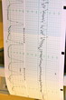 Electrocardiogramme