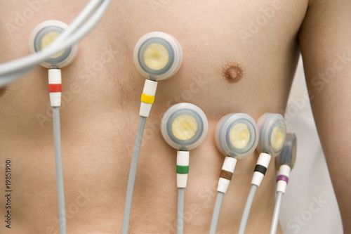 Photo: EKG test EKG test