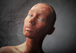 Red skin