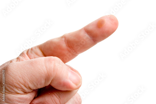 Photo: Blister Blister
