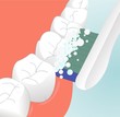 Dental Care
