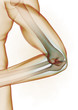 Elbow problem