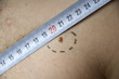 melanoma with hairs on Caucasian man skin with meter melanoma with hairs on Caucasian man skin with meter