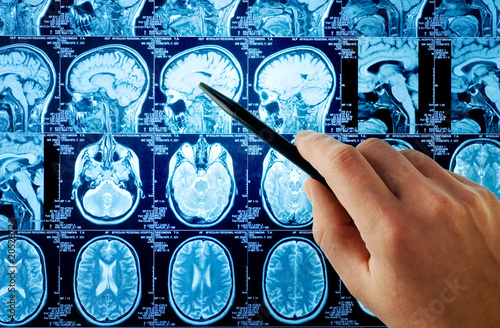 Photo: MRI,brain MRI,brain