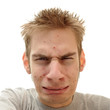 Teenager Acne Problem