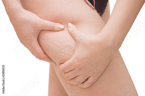Photo: Young woman with cellulite Young woman with cellulite