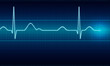 Illustration: ECG Signal ECG Signal