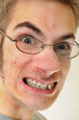 Weird smile