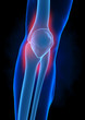 Injured knee concept Injured knee concept